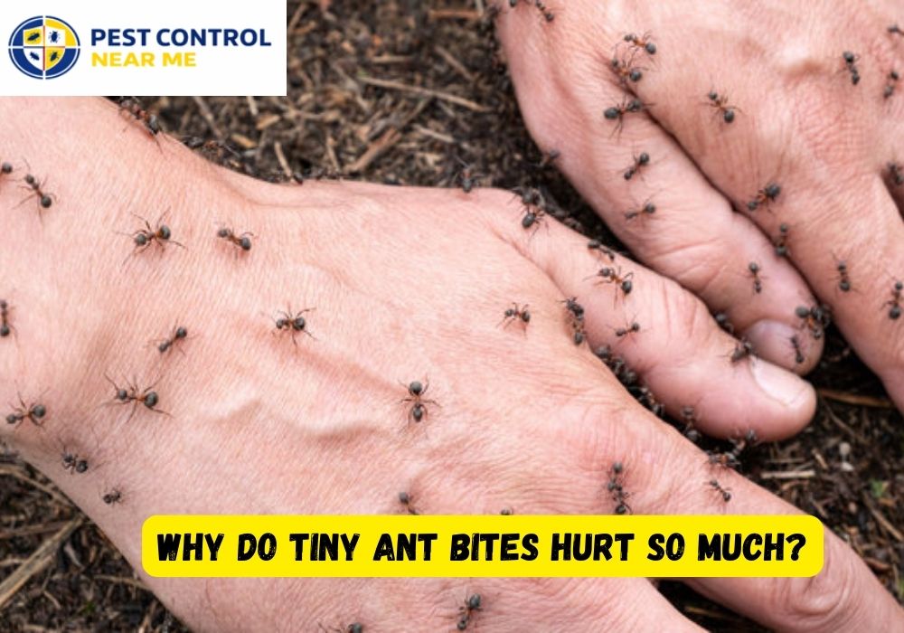 Why Do Tiny Ant Bites Hurt So Much - Pest Control Near Me