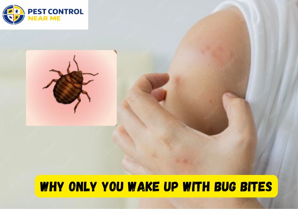 Why Only You Wake Up with Bug Bites - Pest Control Near Me