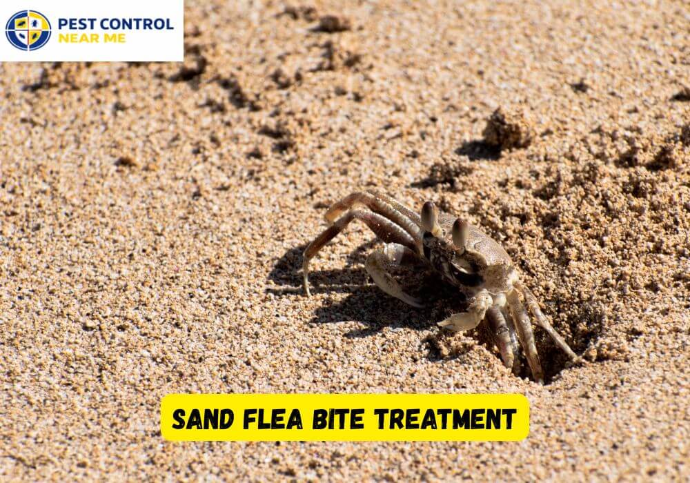 Sand Flea Bite Treatment?