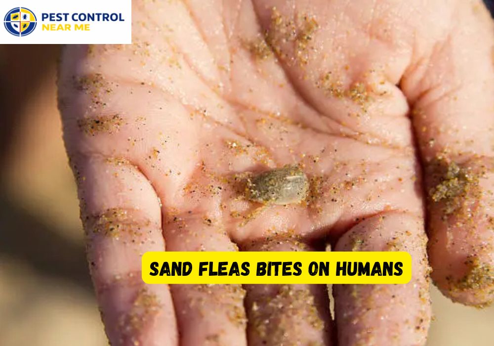 Sand Fleas Bites on Humans?