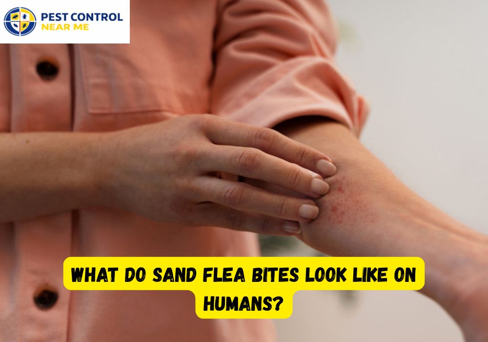 What Do Sand Flea Bites Look Like on Humans